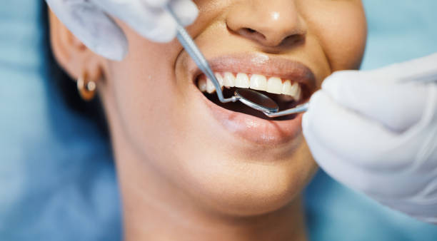 Best Emergency Treatment for Toothache in Naples, TX