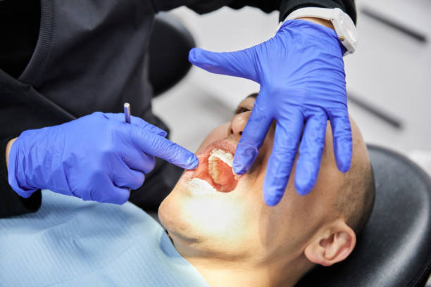 Best Emergency Root Canal Treatment in Naples, TX