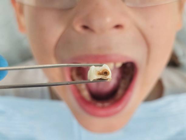 Best After-Hours Emergency Dentist in Naples, TX