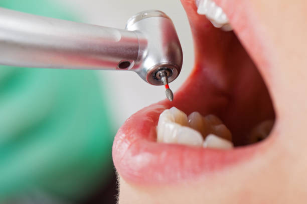 Best Weekend Emergency Dentist in Naples, TX